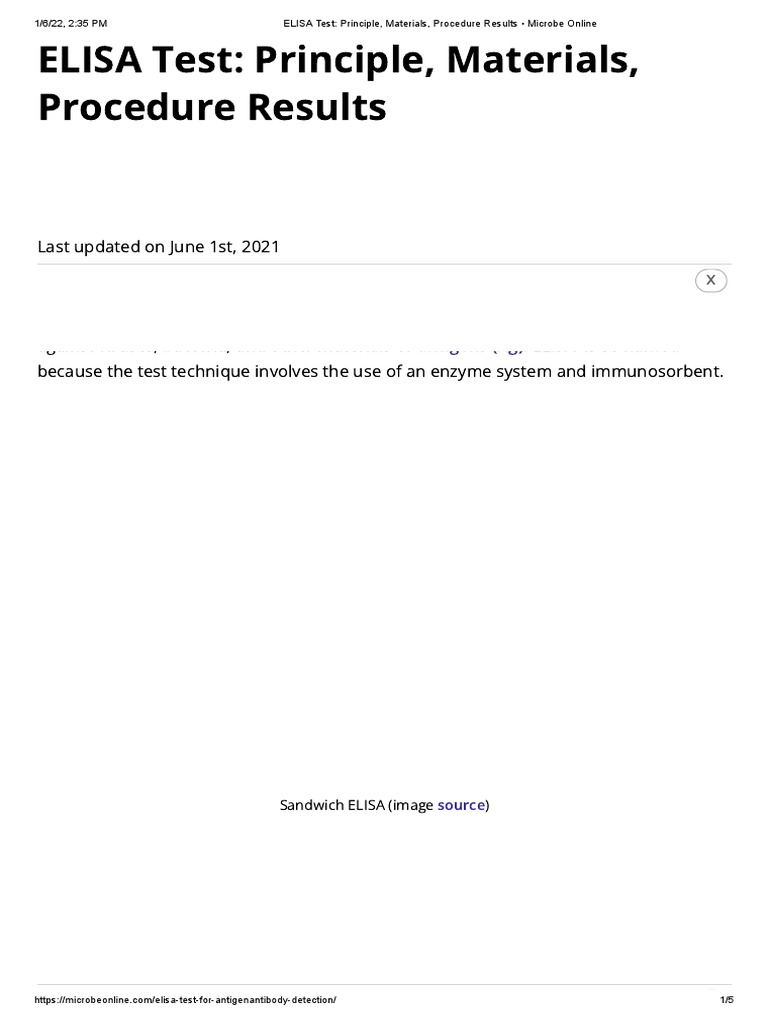 ELISA Test Principle, Materials, Procedure Results Microbe Online