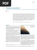 Purpuras vasculaires00