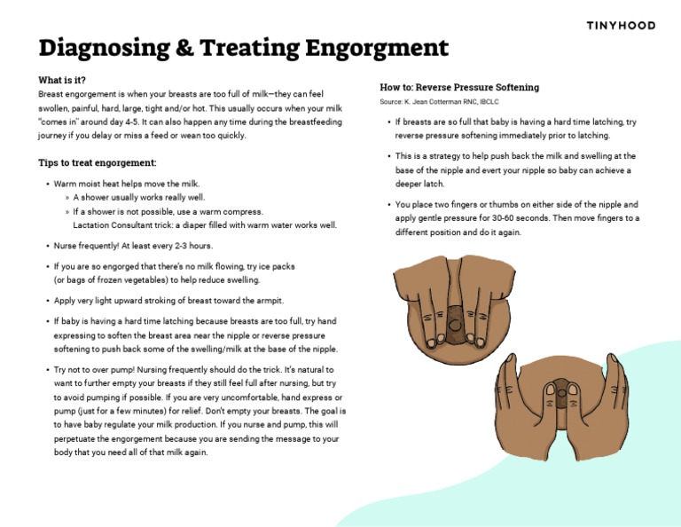 Treating Engorgment (Breastfeeding Guide) | PDF | Breastfeeding | Breast