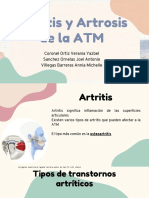 Artritis y Artrosis de La ATM