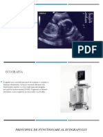 Ecografia Final