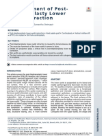 Thetreatmentofpost-Blepharoplastylower Eyelidretraction: Kenneth D. Steinsapir,, Samantha Steinsapir