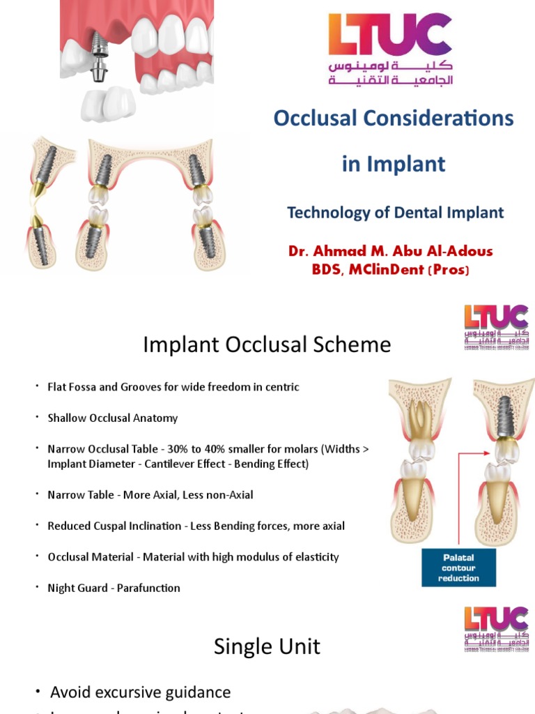 Occlusal Considerations in Implant: Technology of Dental Implant | PDF ...