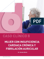 MUJER CON INSUFICIENCIA Cardiaca CRONICA Y FIBRILACION AURICULAR