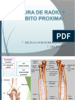 SELINA LOOR Fractura de Radio y Cubito Proximal