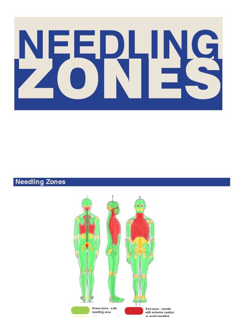 Needling Zones | PDF | Abdomen | Shoulder