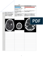 Intracerebral Hemorrhage Subdural Hematoma Subarachnoid Hemorrhage