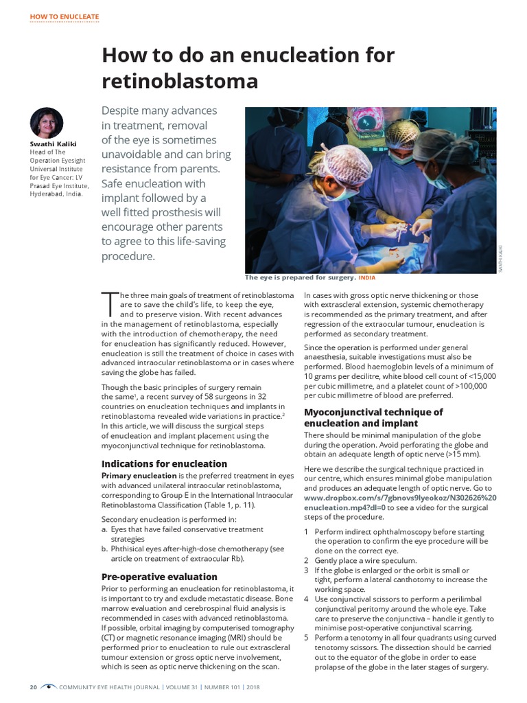 Enucleation Techniques for Retinoblastoma | PDF | Ophthalmology | Human Eye