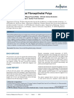 Giant Para-Scrotal Fibroepithelial Polyp