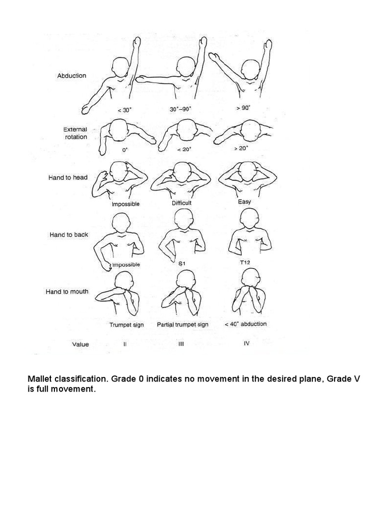 Mallet Classification PBO PDF