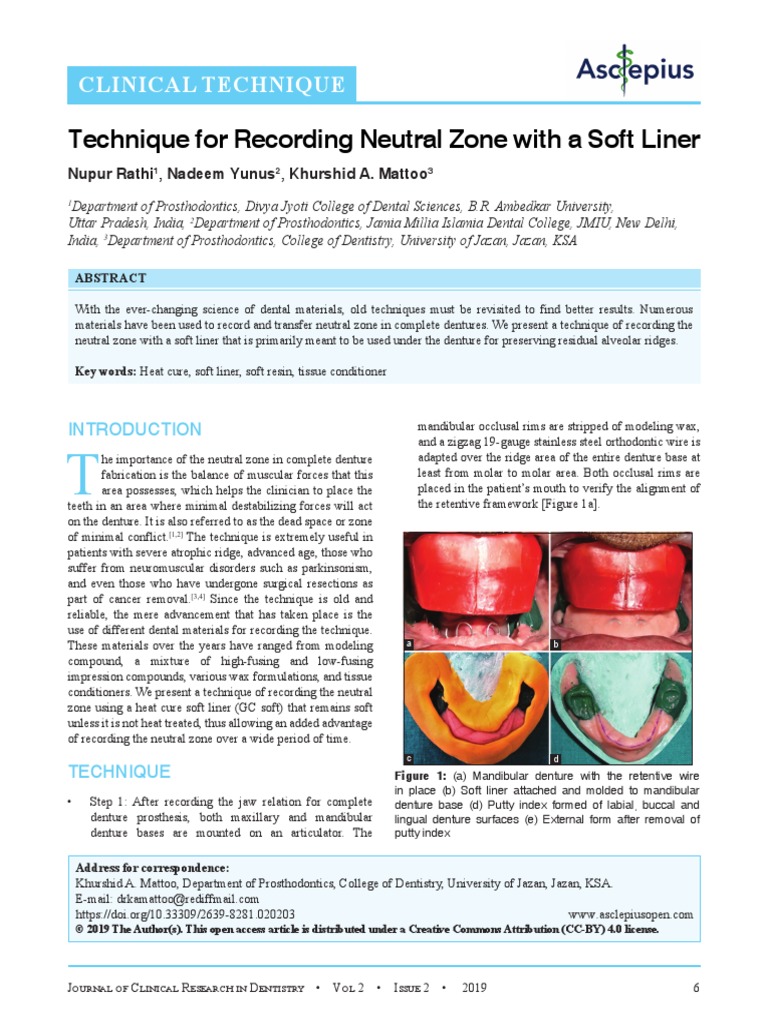 Technique For Recording Neutral Zone With A Soft Liner PDF Dentures