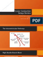 Intraventricular Conduction Delays Review