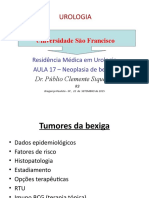 Aula 17 - Neoplasia de Bexiga