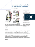 Artritis y Artrosis