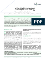 Cryptococcus Gattii and Its Distinctive Yeast Morphology in Cerebrospinal Fluid Cytology