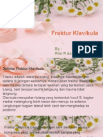 Fraktur Kalvikula