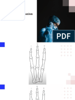 Extensor Mechanism of Hand