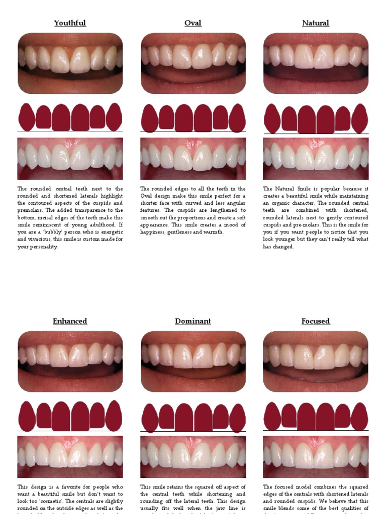 Veneer Shapes PDF Tooth Dentistry Branches