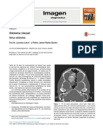 Imagen: Osteoma Sinusal