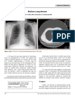 Bullous Lung Disease: Gilbert Berdine, MD and Nopakoon Nantsupawat, MD