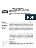 Cinerradiologia de La DegluCion Como Cua