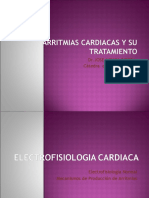 Arritmiascardiacas