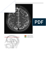 Cortes Anatomicos de Cerebro