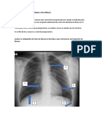 Clínica RX Tórax Normal Con Señales