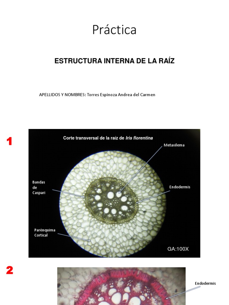Informe Anatomía de Raíz | PDF | Raíz | Botánica