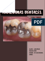 Amalgamas Dentales