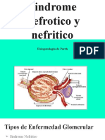 Sindrome Nefrotico y Nefritico