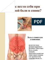 Как Вести Себя При Острой Боли в Спине