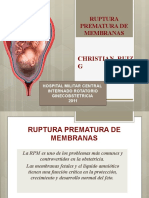 Ruptura Prematura de Membranas: Christian Ruiz G