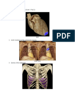 Check List 8 (Items For Lab Exam 1 Part 2) 1. Apex of The Heart