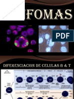 Manifestaciones clínicas de la leucemia