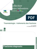 2 .Diagnostic Traitement Fracture Derosa