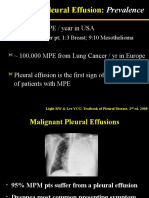 Malignant Pleural Effusion Prevalence