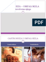 Gastroshiza - Omfalokela