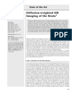 DWI MR Imaging of The Brain