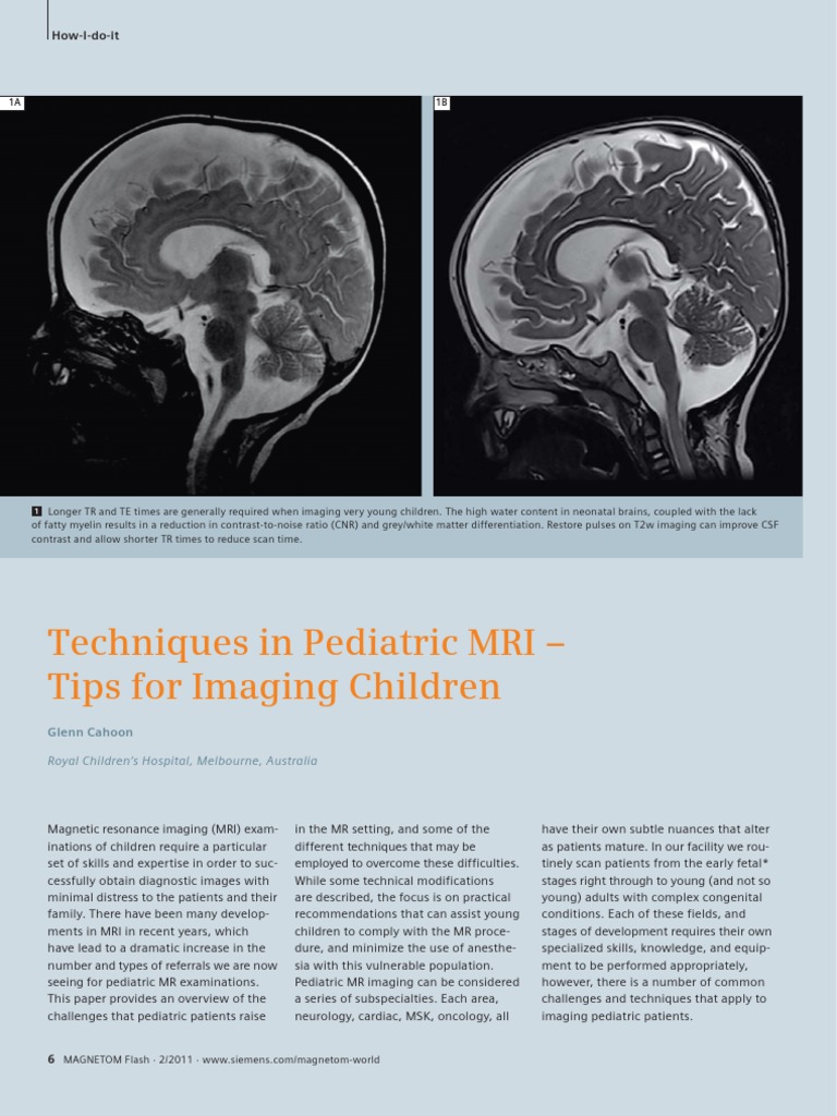 Techniques in Pediatric MRI - Tips For Imaging Children | PDF ...