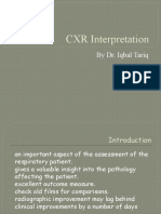 CXR Interpretation: by Dr. Iqbal Tariq