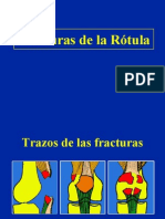04- Fracturas de La Rotula