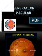 Degeneracion Macular