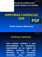 Arritmias Cardiacas