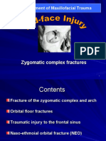 Management of Maxillofacial Trauma: Zygomatic Complex Fractures