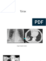 Torax Practica 19-01-22