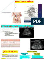 Anatomía y clasificación de quistes renales