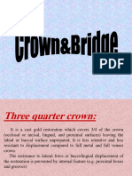 Three quarter crown preparation guidelines