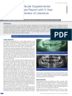 Recurrent Mandibular Supplemental Premolars: A Case Report With 5 Year Follow Up and Review of Literature