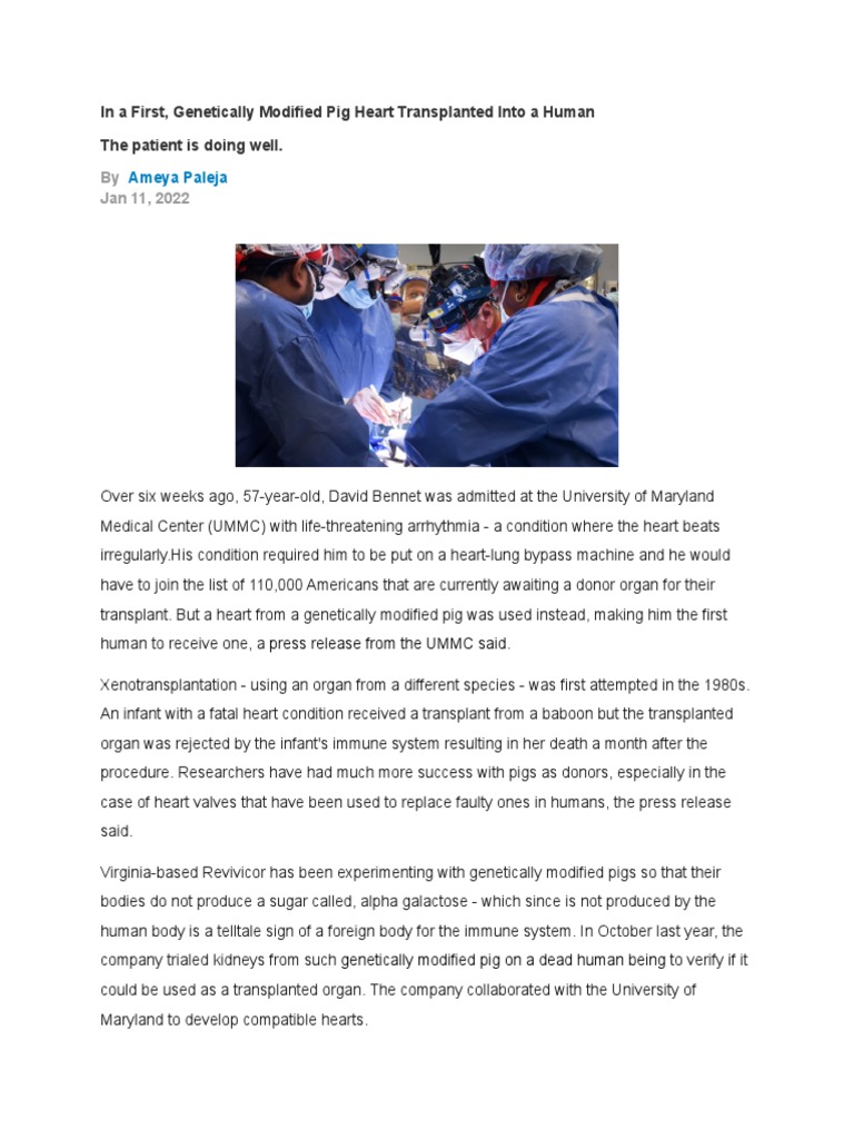 Stimulus Passage #1 - Sem 2 2021-22 | PDF | Organ Transplantation | Surgery